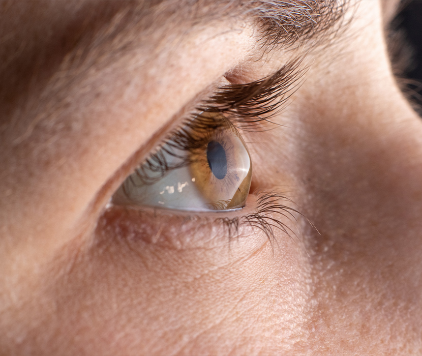Servicio Cornea y superficie ocular Oftoclinic